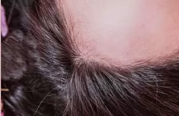 Efekt retuszu za pomocą narzędzia klonowania i odrobiny rozmywania