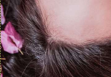 Retusz kwiatka we włosach – pobranie źródła na warstwie z grafiką